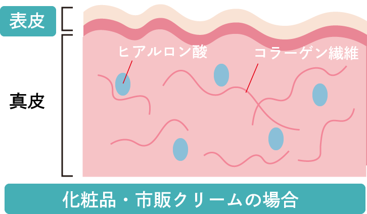 ボライトXCとは