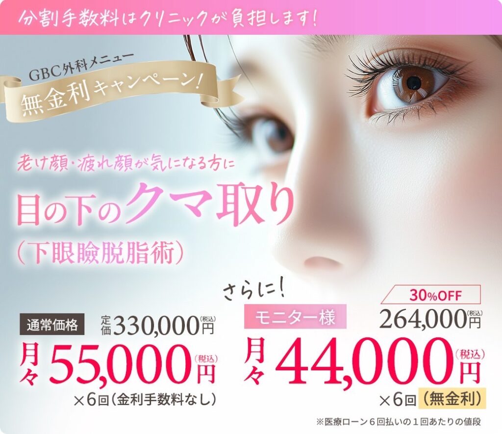 無金利CP 目の下のクマ