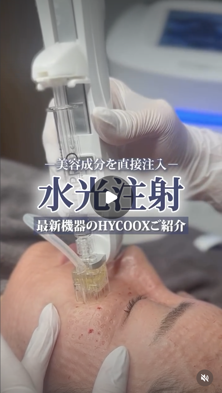 Instagram動画を見る