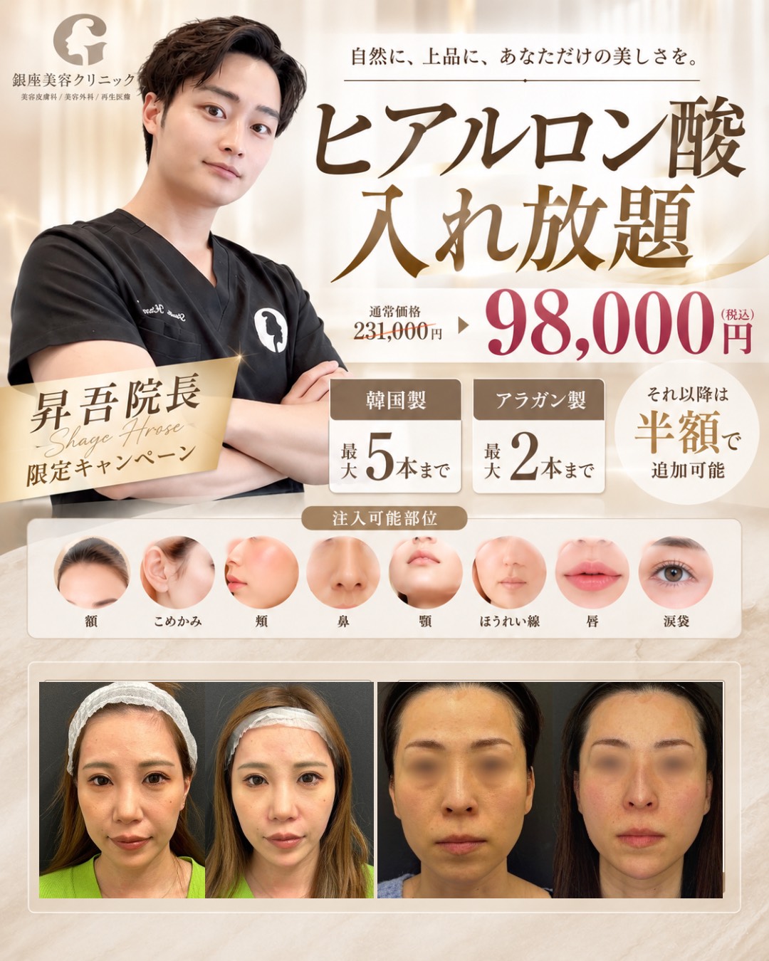 南草津院 ヒアルロン酸入れ放題キャンペーン